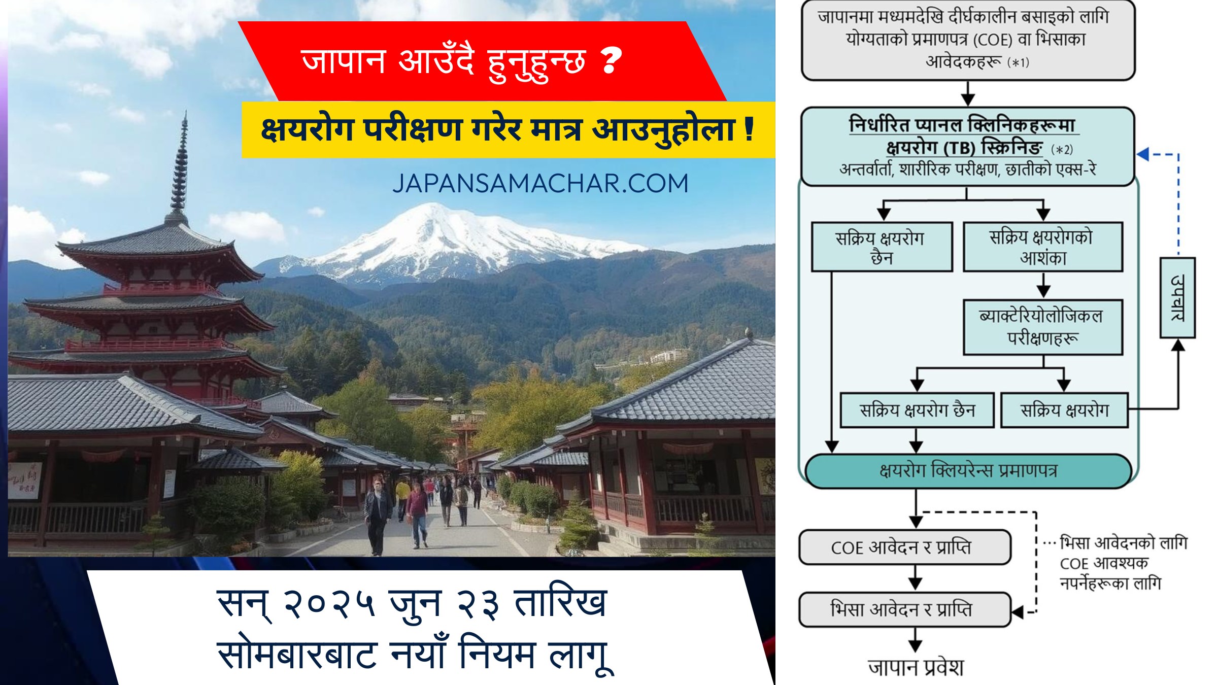 नेपालबाट जापान आउनेले अब क्षयरोगको अनिवार्य चेकजाँच गर्नुपर्ने