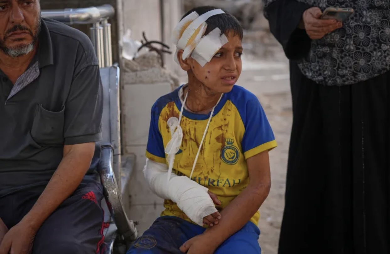 इजरायलको युद्व अपराध : खाद्यान्न राहत कुरिरहेका कम्तिमा ५० जनाको हत्या, १५० बढी घाइते